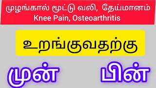 முழங்கால் மூட்டு உடற்பயிற்சி  முழங்கால் மூட்டு வலி தேய்மானம் சிகிச்சை  Knee pain treatment Tamil [upl. by Yerg161]