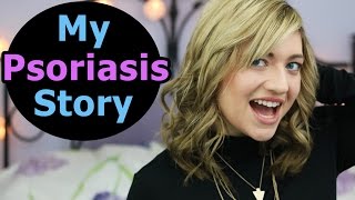 MY PSORIASIS STORY  Psoriasis Treatment Psoriasis Diet Positive Affirmations  Guttate Psoriasis [upl. by Adnohsad237]