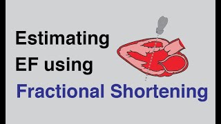 Estimating Ejection Fraction using Fractional Shortening with Cardiac UltrasoundEchocardiography [upl. by Marcelline943]