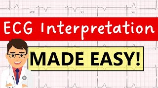 How to interpret an ECG systematically  EXPLAINED CLEARLY [upl. by Auqinu]