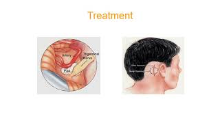 Orofacial pain [upl. by Nolasba741]