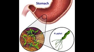 AGENTES MUTÁGENOS QUÍMICOSFÍSICOS Y BIOLÓGICOS  HELICOBACTER PYLORIPAPILOMA VIRUSCITOGENÉTICA I [upl. by Keane]