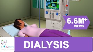 Procedure of DIALYSIS [upl. by Jonna185]