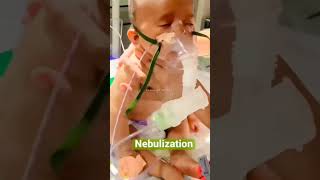 Nebulization in Newborn Read Description 📝📌👩‍⚕️ [upl. by Adnerb]