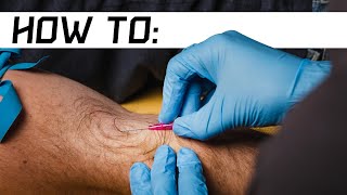 How to Start an IV  Live Demo [upl. by Wershba896]