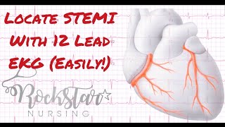 Locate and interpret STEMI based on 12 Lead EKG [upl. by Tnecillim905]