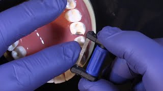 FitStrip Subgingival Finishing Strips from Garrison Dental Solutions [upl. by Adnerak]