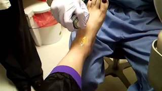 ankle cortisonesteroid pain management injection Dec 16 2011 [upl. by Enileuqcaj113]