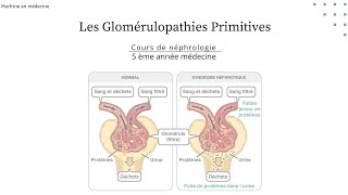 les Glomérulopathies Primitives  LGM HSF GEM maladie de BERGER GNMP GNRP nephro [upl. by Areek182]