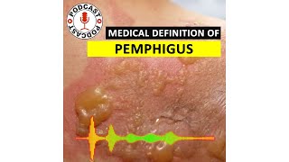 Pemphigus Medical Definition of Pemphigus HaileyHailey disease Podcast [upl. by Kissee192]