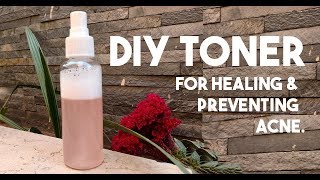 HomeMade Skincare  DIY Toner For All Skin Problems  100 Effective  GLOSSIPS [upl. by Ludwig]