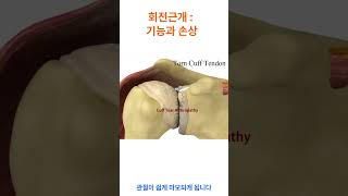 회전근개 파열과 관절염 건강한 회전근개와 파열 Rotator Cuff Tears and Arthritis The Impact on Shoulder Stability [upl. by Nahtanhoj]