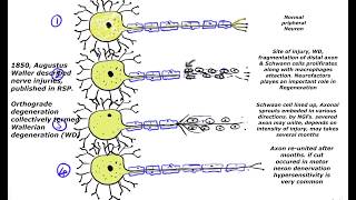 Wallerian degeneration regeneration process of nerve fiberaxon cut and progressive response [upl. by Airpal437]