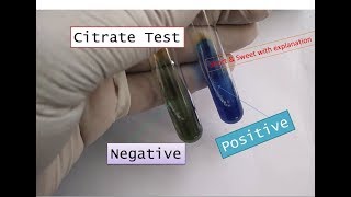 Citrate Utilization test positiveCitrate testCitrate positive bacteria in microbiology practical [upl. by Menedez]