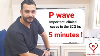 As simple as this  Mastering P wave clinical cases in the ECG in 5 minutes [upl. by Kier]