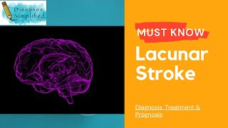 Must Know Lacunar Stroke [upl. by Akehsal]