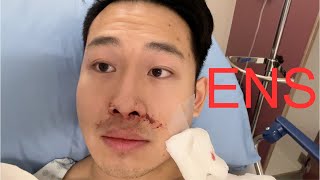 Deviated Septum Surgery  2 Week Review and Recovery  Septoplasty and Turbinate Reduction [upl. by Essirahc]