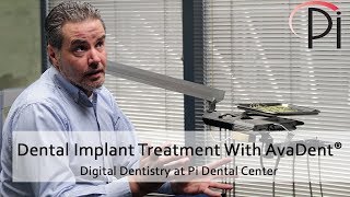 AvaDent® Digital Dental Implants and Treatment [upl. by Dayir]