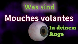 Mouches volantes Richtige Sprechweise Bedeutung Korrekte Aussprache Gutes Deutsch Fleck im Auge [upl. by Mika40]