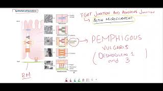 Pemphigus vulgaris vs Bullous pemphigoidEpithelial cell junctions [upl. by Dita361]