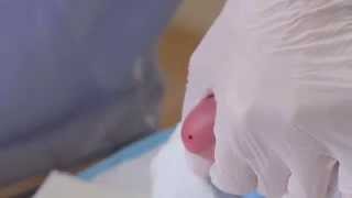 CLSI Newborn Screening DVD  Informational Video Trailer [upl. by Id343]