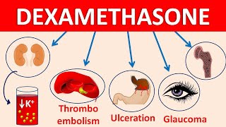 Dexamethasone tablets decadron  Mechanism side effects amp precautions [upl. by Edalb]