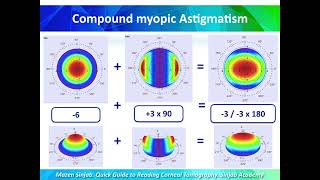 A Quick Guide to Reading Corneal Tomography Part 3 [upl. by Connelley]