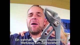 How to pull a milk tooth the traditional way pliers [upl. by Enelaehs]