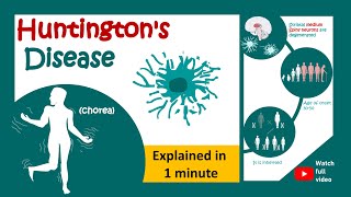 Huntingtons disease in 1 minute  1 minute pathology  Huntingtons chorea [upl. by Ida]