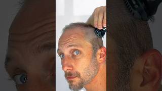 Best trimmers and shavers [upl. by Glenda]