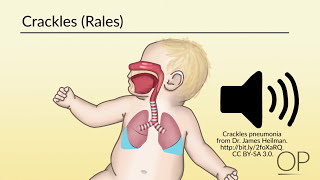 Respiratory Assessment by B Leary L DelSignore  OPENPediatrics [upl. by Aleacem]