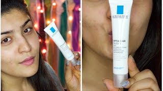 La Roche Posay Effaclar Duo Review  How I faded my acne scars [upl. by Ynnel]