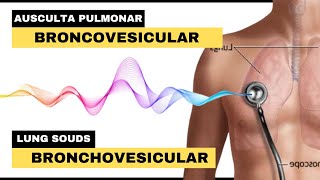 SOM BRONCOVESICULAR AUSCULTA PULMONAR  Bronchovesicular Breath Sounds  Lung Sounds [upl. by Gnep221]