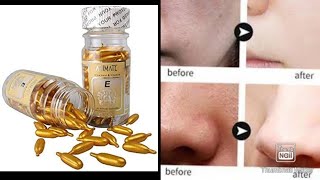 animate vitamin e amp aleo vera capsul facial oil glowing skinbaby skinremove ageing [upl. by Eiznikcm]