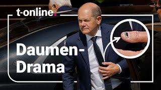 Olaf Scholz Das steckt hinter dem blauen KanzlerDaumen [upl. by Calysta860]