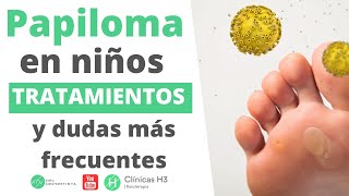 Papiloma en los pies de los niños y su tratamiento en Clínicas H3 [upl. by Nollid]