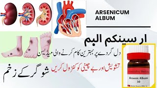 Arsenicum Album 30 200  Arsenicum uses and benefits  Rizwan Homoeopathic clinic [upl. by Jilli798]