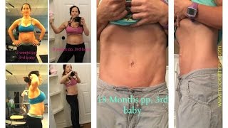 Your Guide to Treating Diastasis Recti PART 1 [upl. by Earlene98]