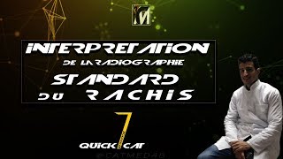 QUICK EP 1  INTERPRÉTATION DUNE RX ST DU RACHIS [upl. by Inohs]