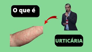 Urticária você sabe o que é isso [upl. by Acir]