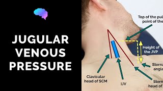 Measuring Jugular Venous Pressure JVP  OSCE Guide Clip  UKMLA  CPSA [upl. by Gibe]