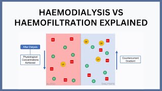 Haemodialysis vs Haemofiltration Explained [upl. by Bathilda]