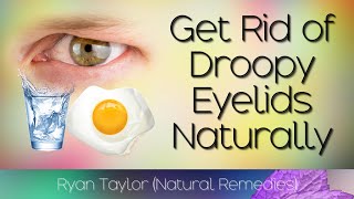 How To Lift Droopy Eyelids Naturally [upl. by Ara]