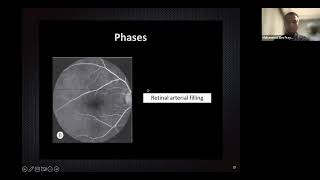 Retinal Vascularization amp FFA Mohammad Eko Prayogo [upl. by Ymmik]