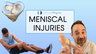 Meniscal injuries and Meniscus Tears  Expert Review on Assessment and Treatment [upl. by O'Kelly535]