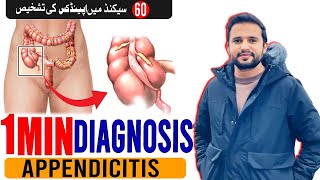 Appendicitis  60 Seconds Diagnosis by Dr Shoaib [upl. by Ellirehs]