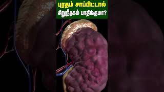 புரதம் சாப்பிட்டால் சிறுநீரகம் பாதிக்குமா  Does eating protein affect the kidney  Dr Arunkumar [upl. by Burris]