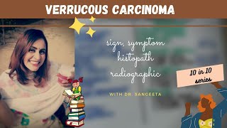 verrucous carcinoma I oral path [upl. by Mlawsky]