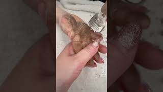 Does soaking help with shaving keratoderma skin  EPPK in kid hands  Feb 28 2023 [upl. by Marpet]