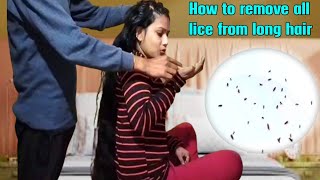 Remove all lice from girls long hair by collage friend  how to remove all lice from long hair head [upl. by Missi97]